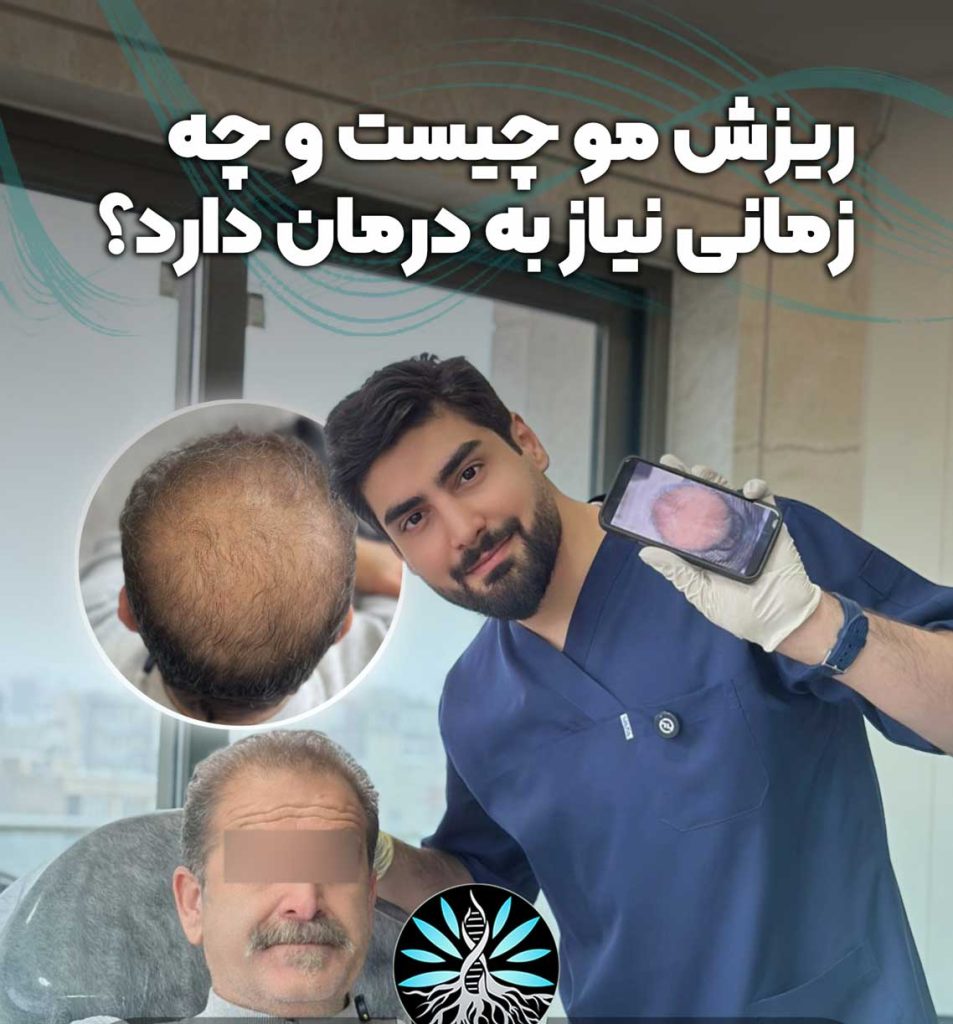 درمان ریزش مو در مشهد