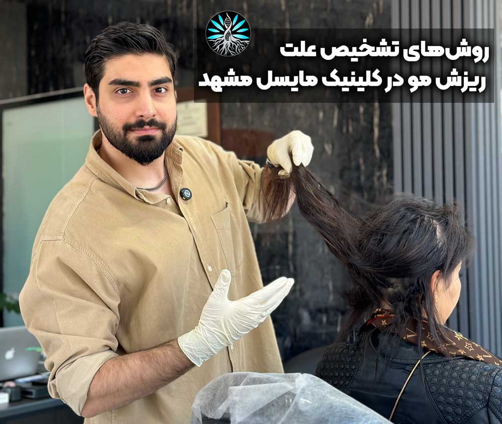 درمان ریزش مو در مشهد
