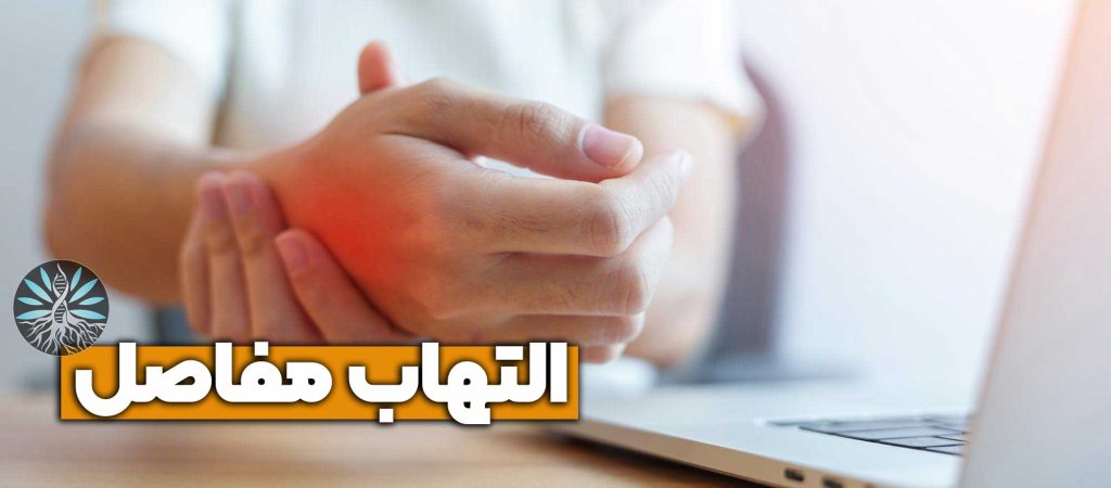 درمان التهاب مفاصل